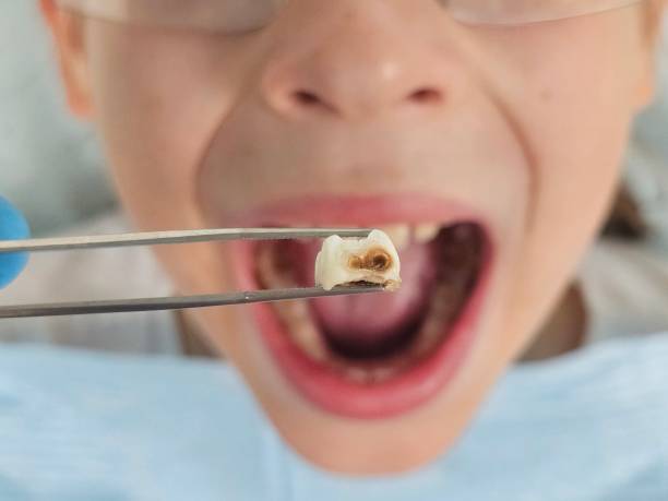 Best Pediatric Emergency Dentist in Chagrin Falls, OH